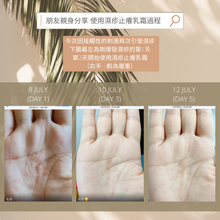 Load image into Gallery viewer, Eczema Anti-Itch Cream 濕疹止癢乳霜