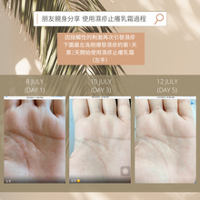 Load image into Gallery viewer, Eczema Anti-Itch Cream 濕疹止癢乳霜